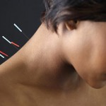 holistic health acupuncture